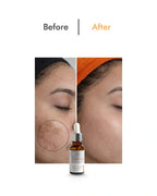 Trubella Vitamin C Serum