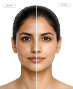 glutawhite cream before and after female results