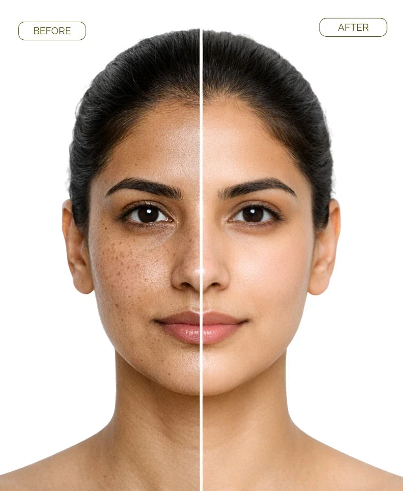 glutawhite cream before and after female results