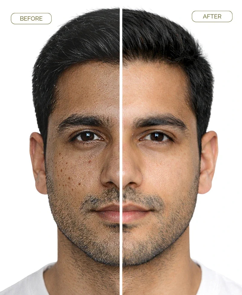 Gluta White Cream – Skin Whitening Cream in Pakistan
